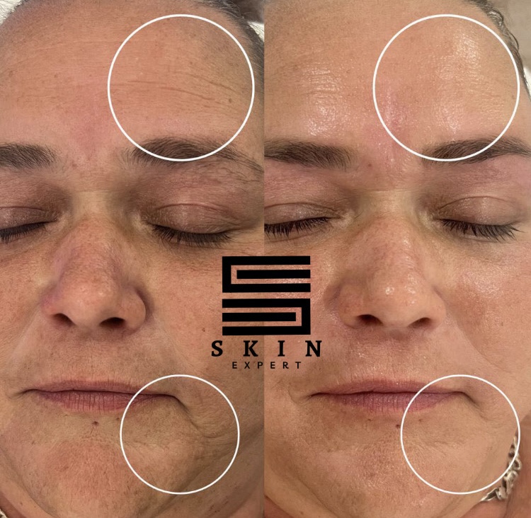 Soin visage anti-âge à Roubaix pour femme